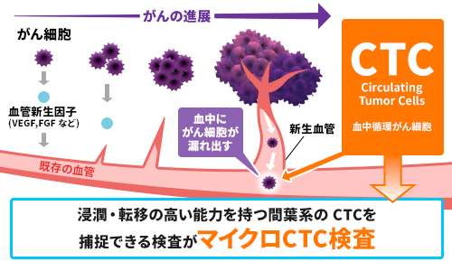 CTCとは