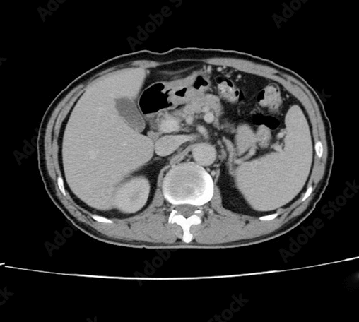 CT/MRI/PET